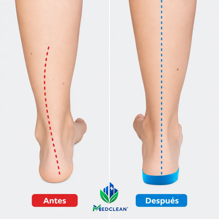 Plantillas Ortopedicas Fascitis Plantar Anatomica Pie Plano