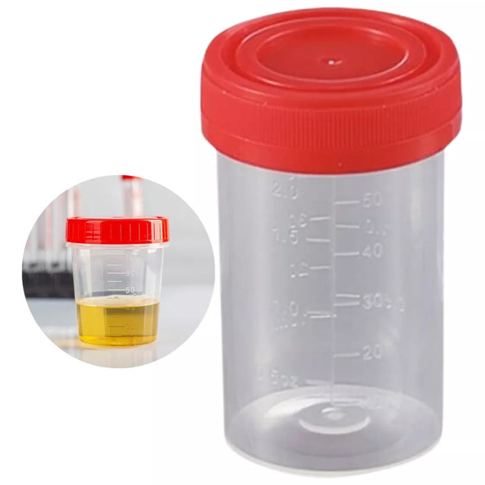 Frasco Recolector Muestras De Orina Frascos Esteril 60 Ml